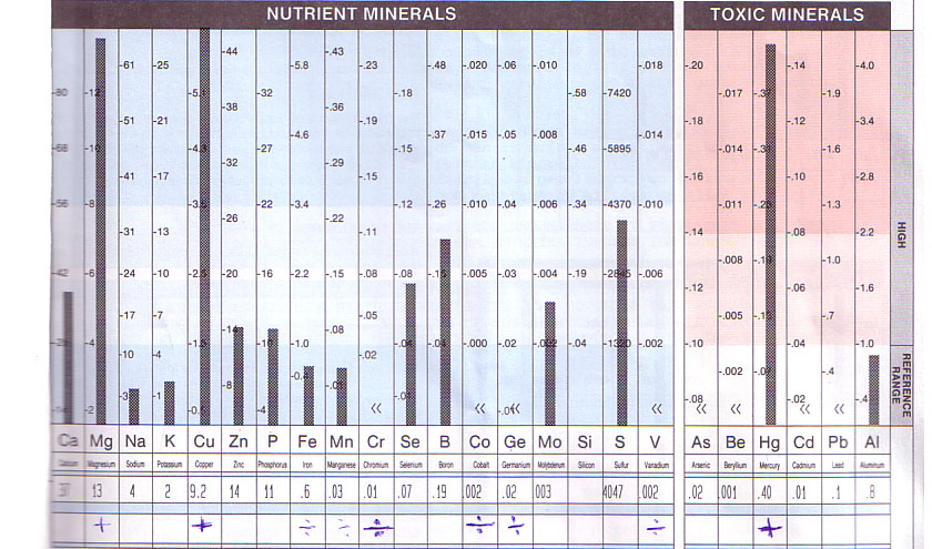 haarmineralanalyse-aluminium-01-hma-ps-19980817-tei-trace-elements-incorporated